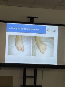 Materiały z superwizji oraz szkolenia pt.: „Pierwszorzędowe i drugorzędowe anomalie w budowie u dzieci z FASD”