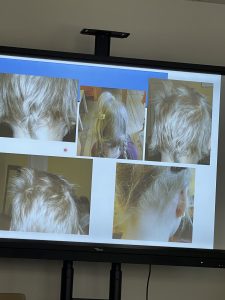 Materiały z superwizji oraz szkolenia pt.: „Pierwszorzędowe i drugorzędowe anomalie w budowie u dzieci z FASD”